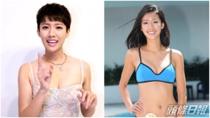 蔡思貝意外撞歪鼻，突然神奇變靚鼻，原來(lái)靠這位男星的雙手