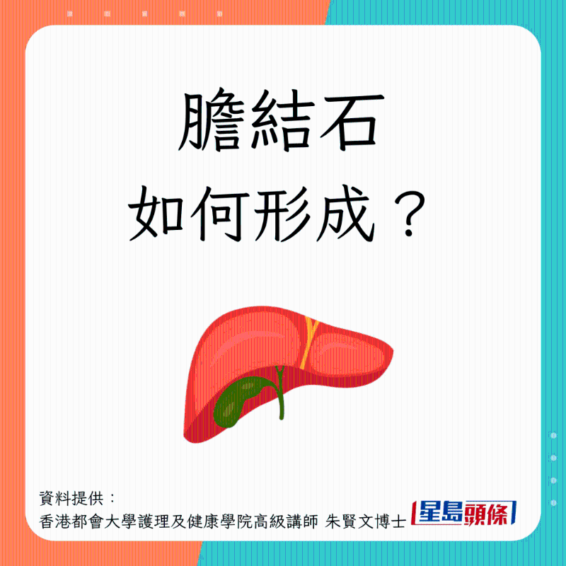膽結(jié)石形成過程