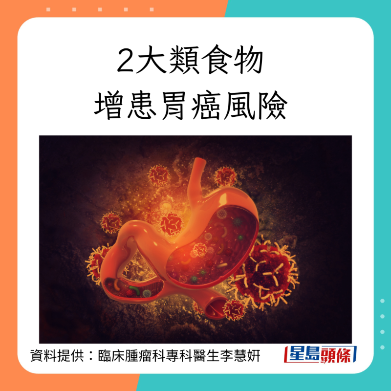 2大類食物增患胃癌風(fēng)險(xiǎn)