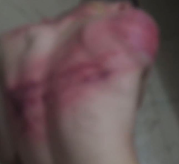 片中有被禁錮的人慘遭虐待。 （央視新聞微博截圖）