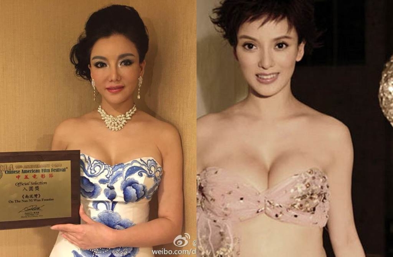 彭丹近些年被指樣貌大改變