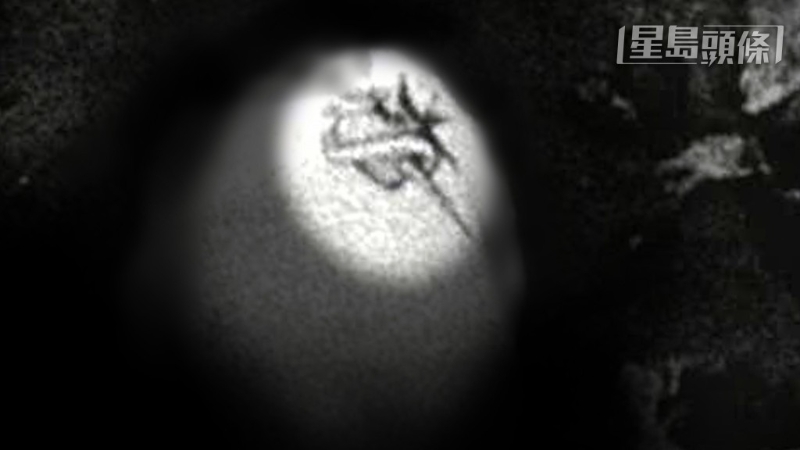 尸體手臂上的特別紋身圖案揭開死者身世。 資料圖片