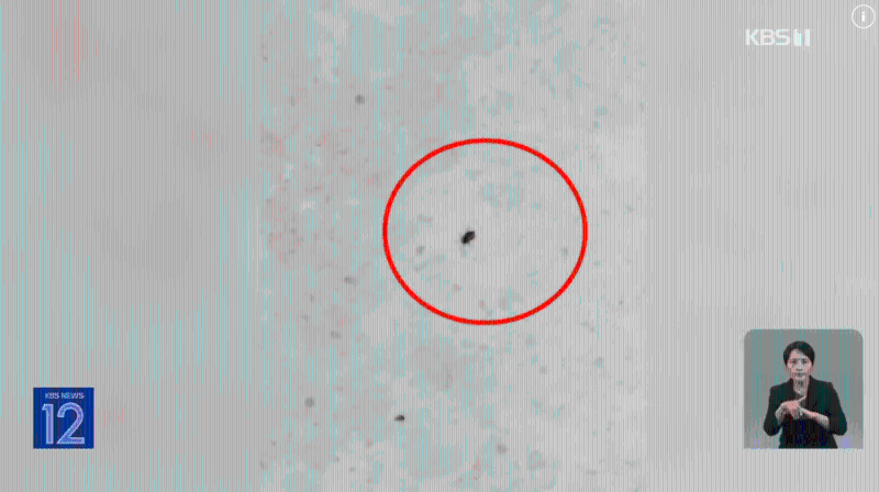 床蝨極為細(xì)小（影片截圖：KBS）