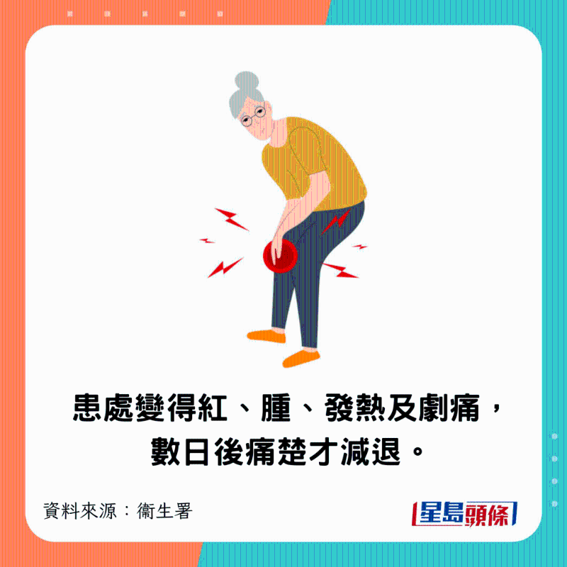 患處突然變得紅、腫、發(fā)熱及劇痛，數(shù)日后痛楚才減退。