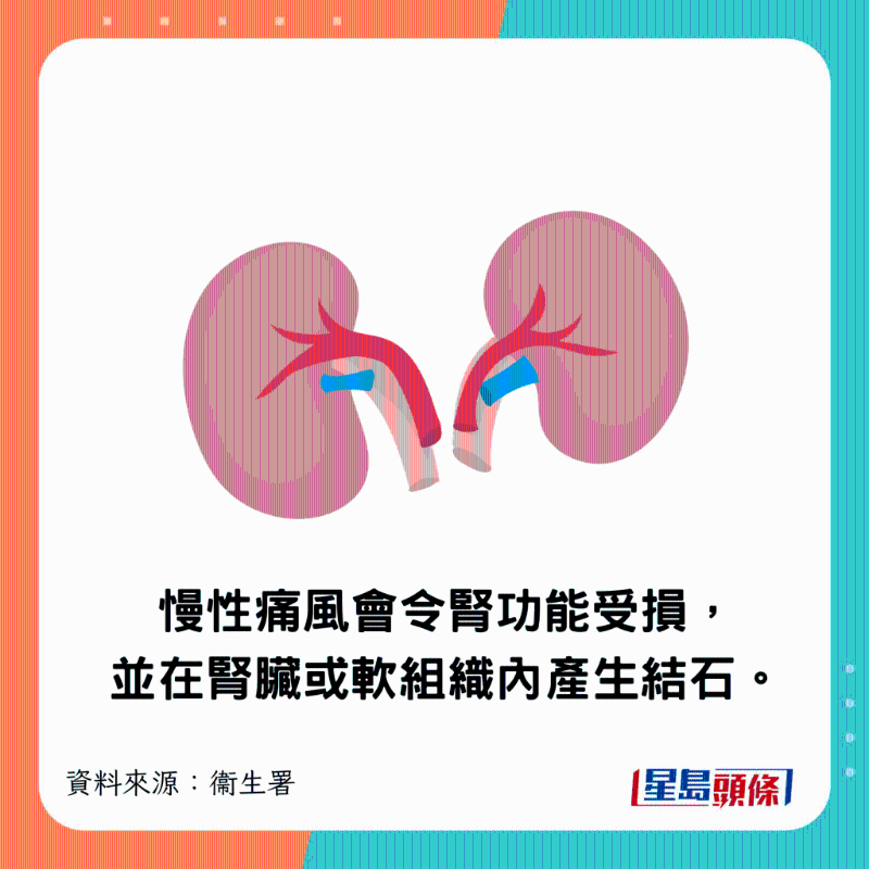 慢性痛風(fēng)會令腎功能受損，并在腎臟或軟組織內(nèi)產(chǎn)生結(jié)石。