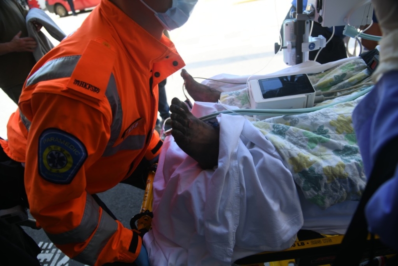 雙腳皮膚焦黑 雙腳皮膚焦黑