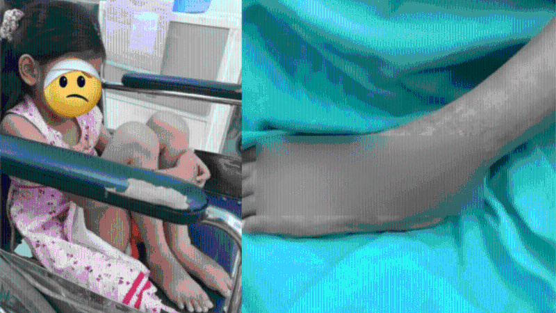 網(wǎng)民爆料附上受害女童傷勢(shì)照片。