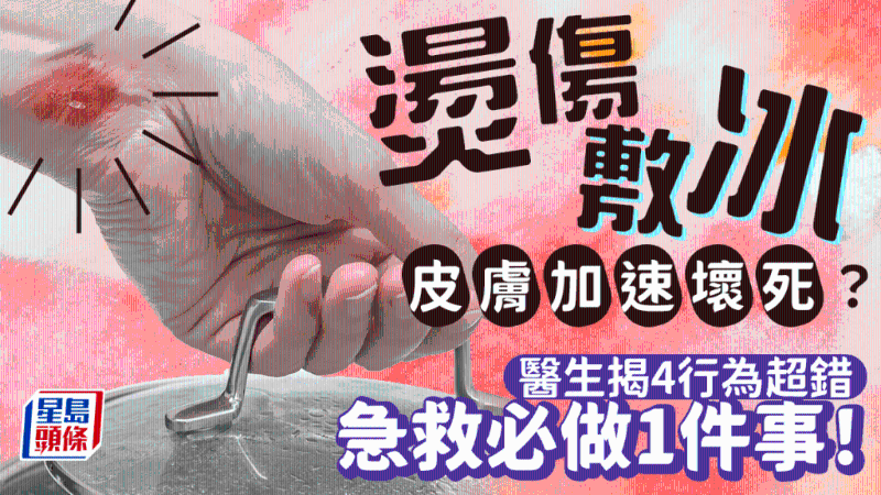 燙傷立即敷冰超錯(cuò)