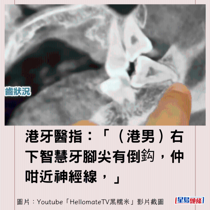 港牙醫(yī)指深圳牙醫(yī)犯三大錯(cuò)12 港牙醫(yī)指深圳牙醫(yī)犯三大錯(cuò)12