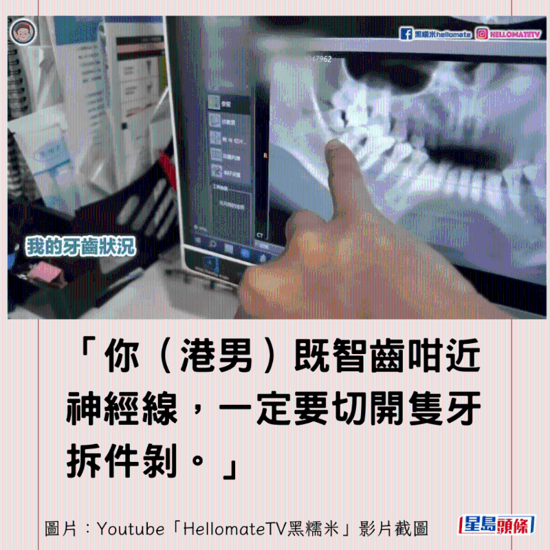 港牙醫(yī)指深圳牙醫(yī)犯三大錯(cuò)9 港牙醫(yī)指深圳牙醫(yī)犯三大錯(cuò)9