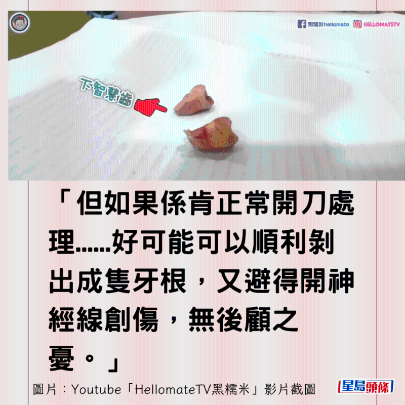 港牙醫(yī)指深圳牙醫(yī)犯三大錯(cuò)6 港牙醫(yī)指深圳牙醫(yī)犯三大錯(cuò)6