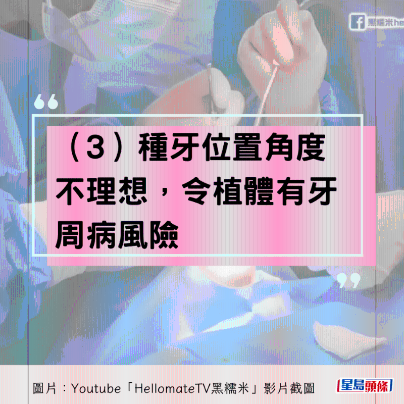 港牙醫(yī)指深圳牙醫(yī)犯三大錯(cuò)5 港牙醫(yī)指深圳牙醫(yī)犯三大錯(cuò)5