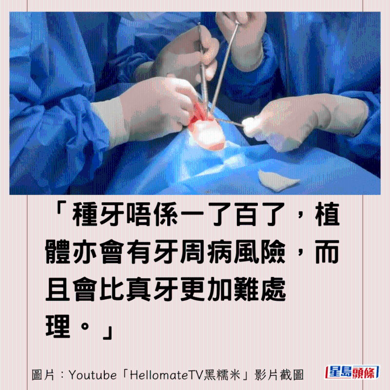 港牙醫(yī)指深圳牙醫(yī)犯三大錯(cuò)3 港牙醫(yī)指深圳牙醫(yī)犯三大錯(cuò)3