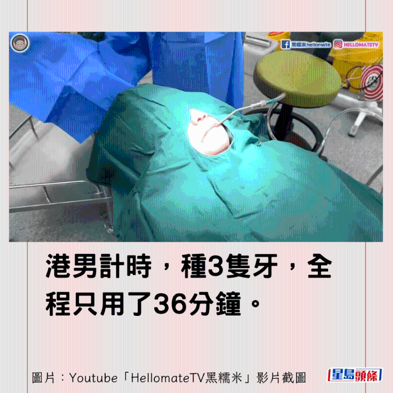 香港男子實(shí)測(cè)深圳平價(jià)洗牙種牙9 香港男子實(shí)測(cè)深圳平價(jià)洗牙種牙9
