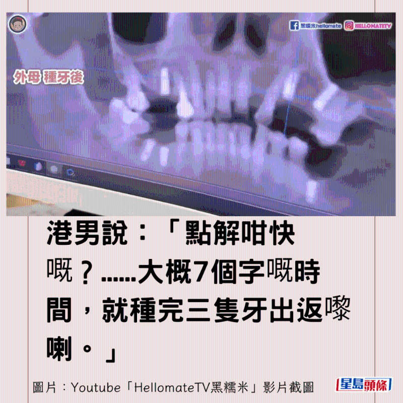 香港男子實(shí)測(cè)深圳平價(jià)洗牙種牙8 香港男子實(shí)測(cè)深圳平價(jià)洗牙種牙8