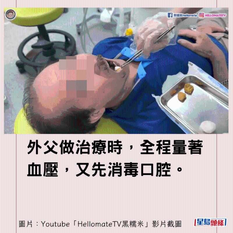 香港男子實(shí)測(cè)深圳平價(jià)洗牙種牙5 香港男子實(shí)測(cè)深圳平價(jià)洗牙種牙5