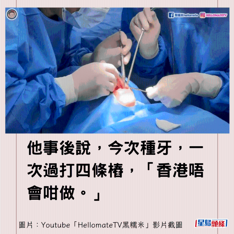 香港男子實(shí)測(cè)深圳平價(jià)洗牙種牙4 香港男子實(shí)測(cè)深圳平價(jià)洗牙種牙4