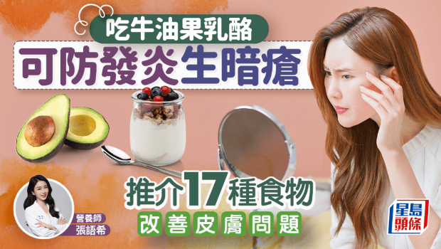 吃牛油果奶酪可防發(fā)炎生暗瘡？