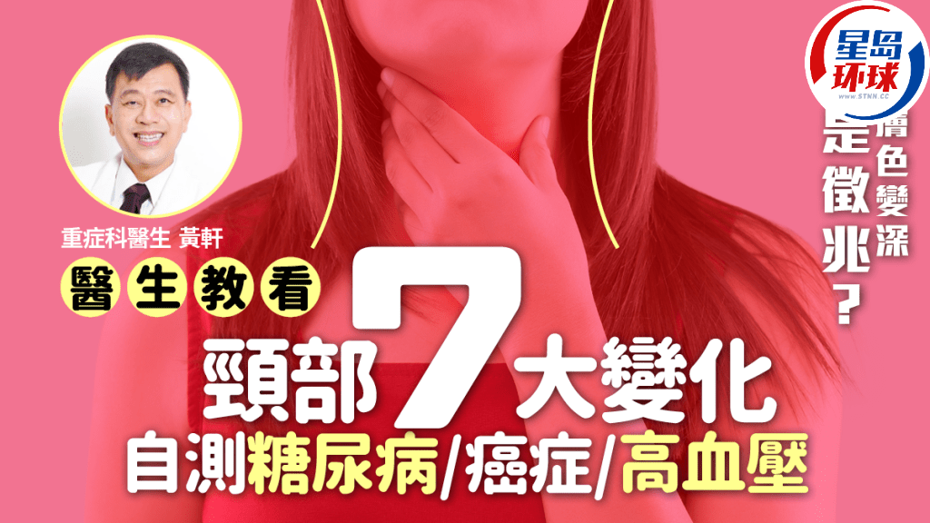 頸部7大變化 頸部7大變化