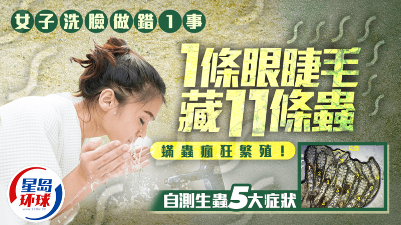 自測(cè)生蟲5大癥狀