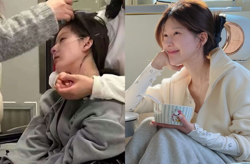 對(duì)比之前病倒、插管的樣貌，趙露思?xì)馍棉D(zhuǎn)許多。（圖／趙露思IG）