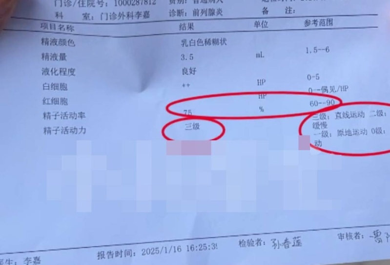 醫(yī)院人員解釋李先生精子太活躍?！缎±驇兔Α奉l道