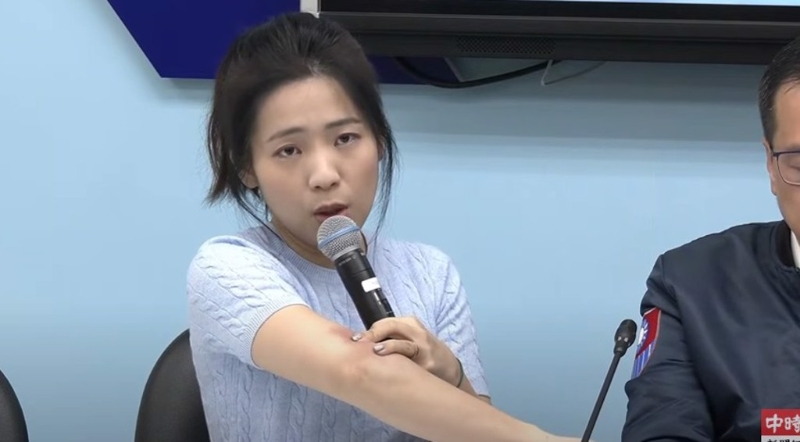 國民黨立委徐巧芯秀傷痕照。（取自直播）