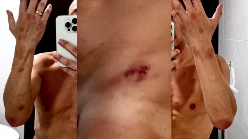 王喜全身滿布血痕。