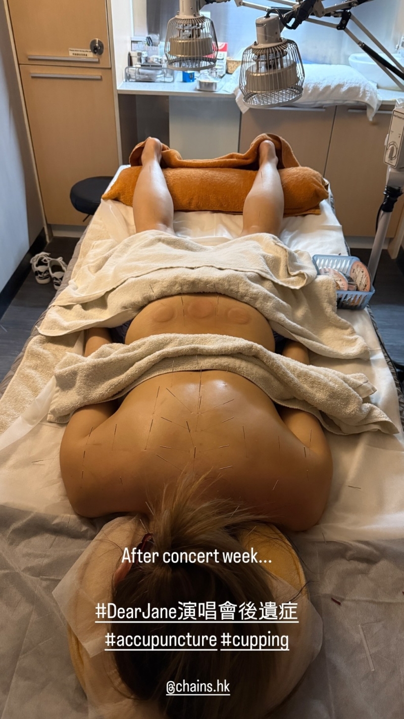 楊洛婷到醫(yī)療中心針炙和拔罐，畫面觸目驚心。