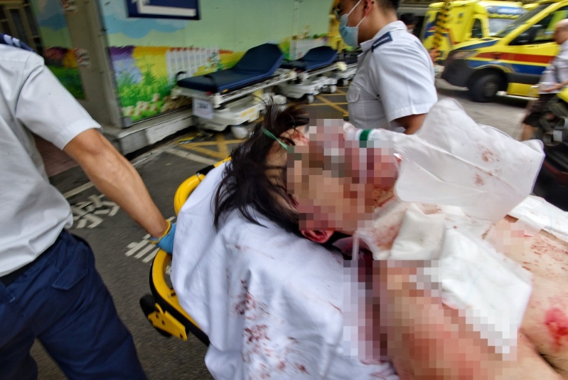 傷者送院搶救。