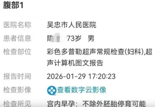 示意圖1 示意圖1