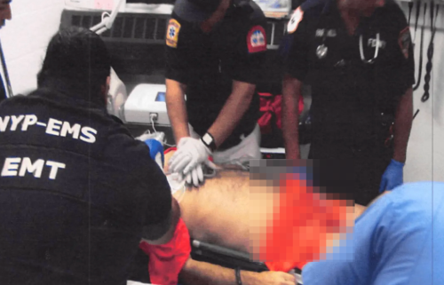 急救人員正在對愛潑斯坦進(jìn)行心肺復(fù)蘇