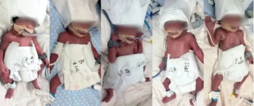 24歲新疆產(chǎn)婦誕5胞胎