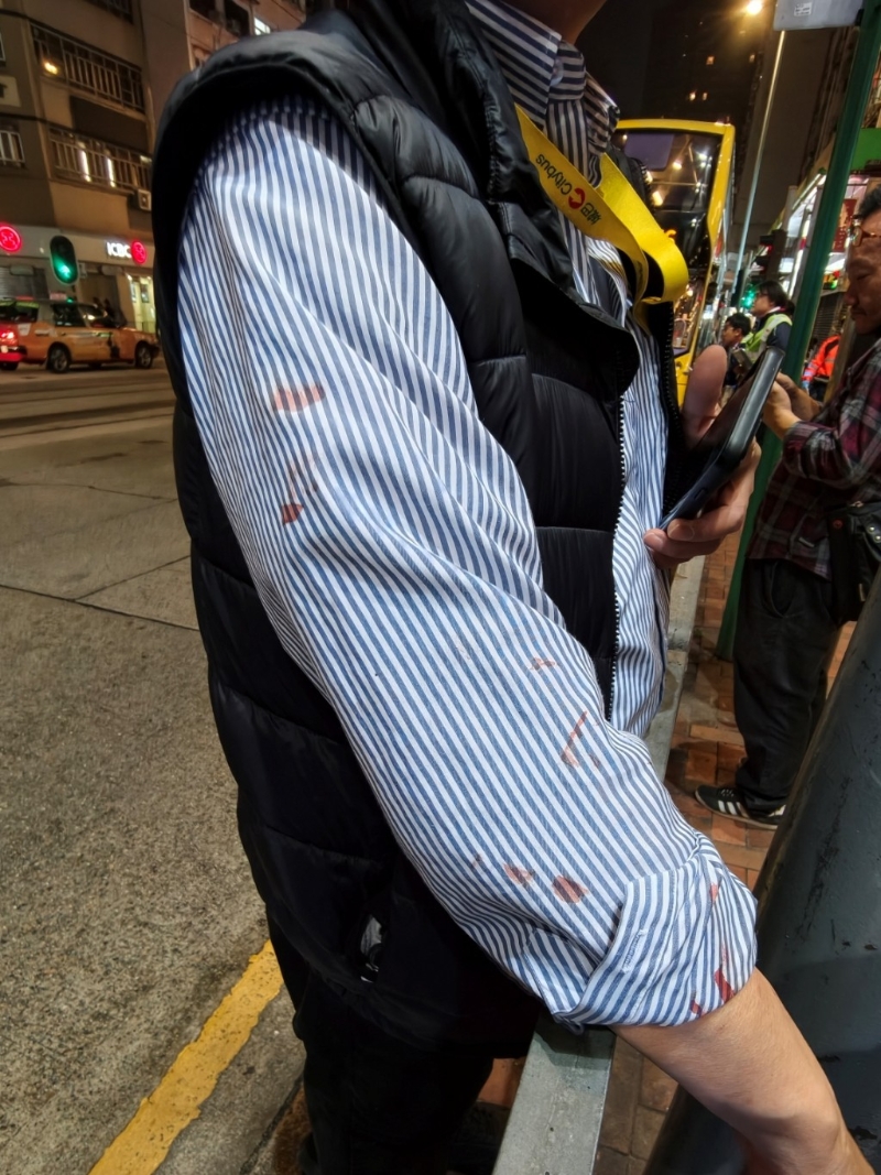 車長制服被疑犯血跡所染。